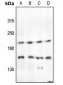 Anti-PTP kappa Antibody